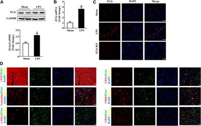 Il12a Deletion Aggravates Sepsis-Induced Cardiac Dysfunction by Regulating Macrophage Polarization